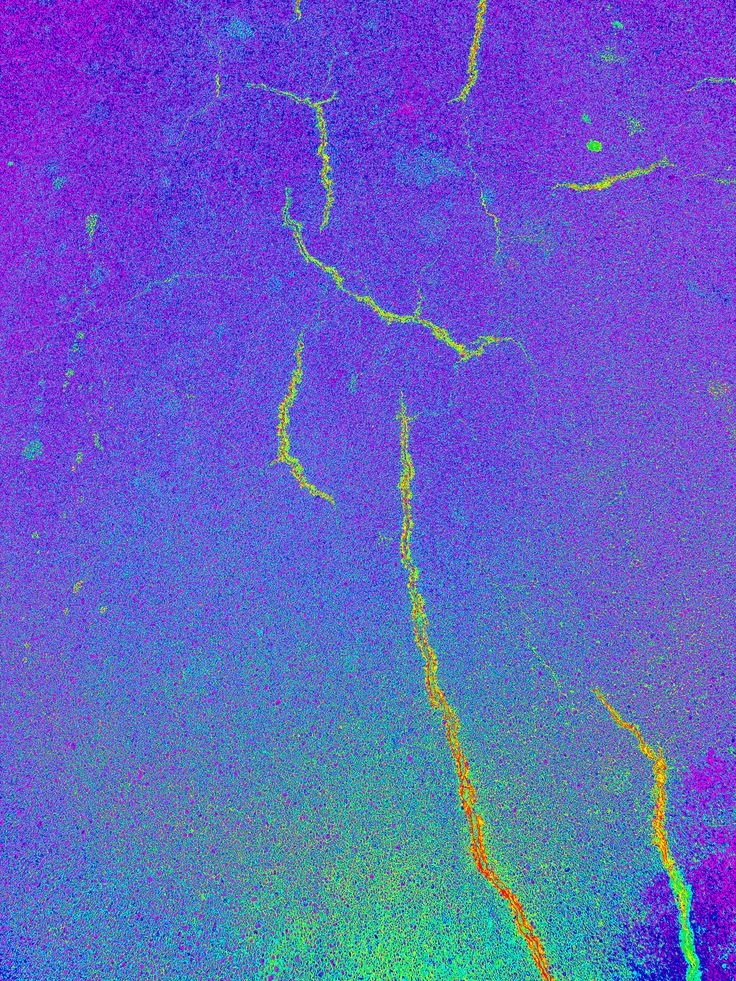 #DA2500157 microscopic